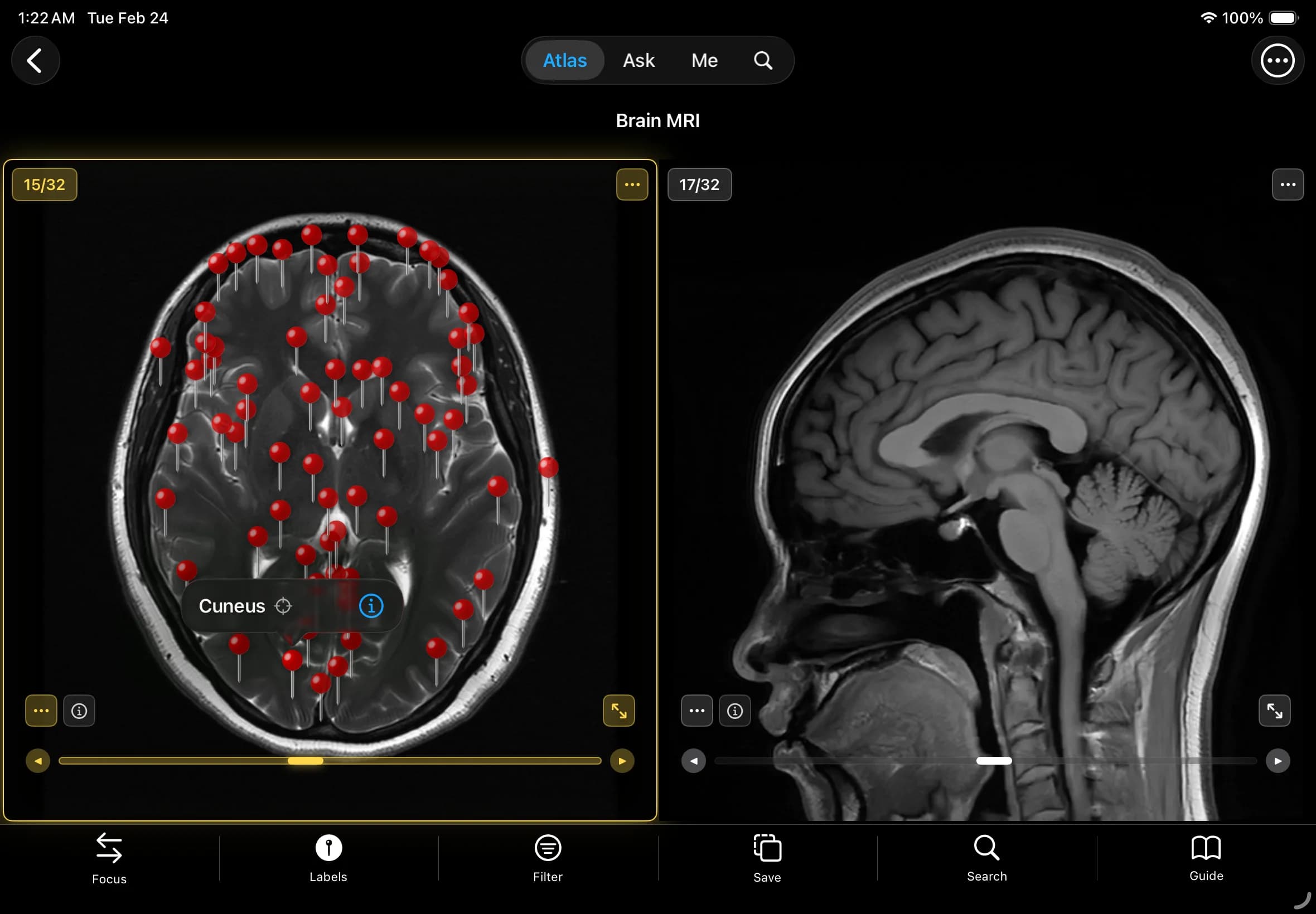 详尽精准标注 - 1