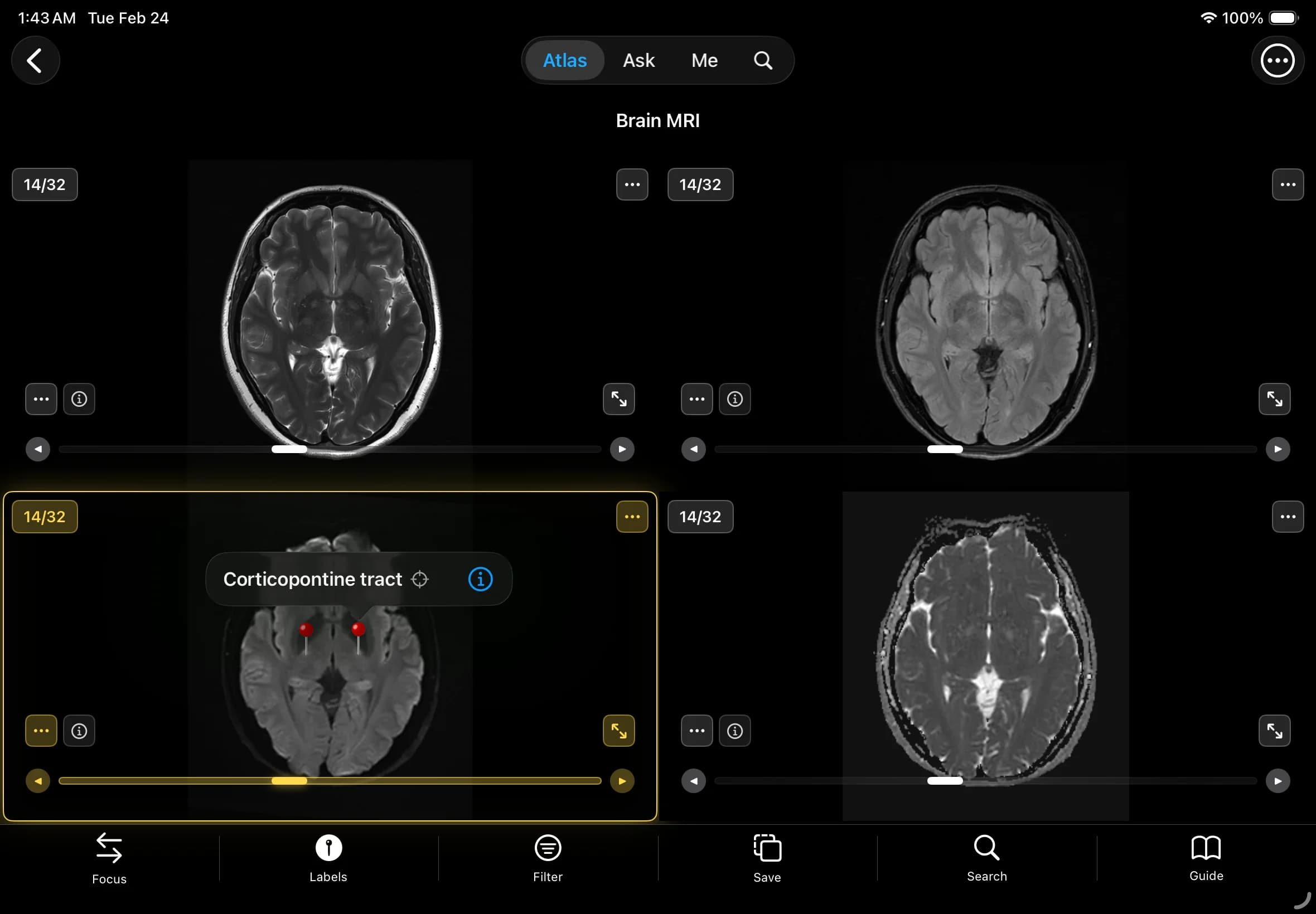 临床级精心打造 - 1