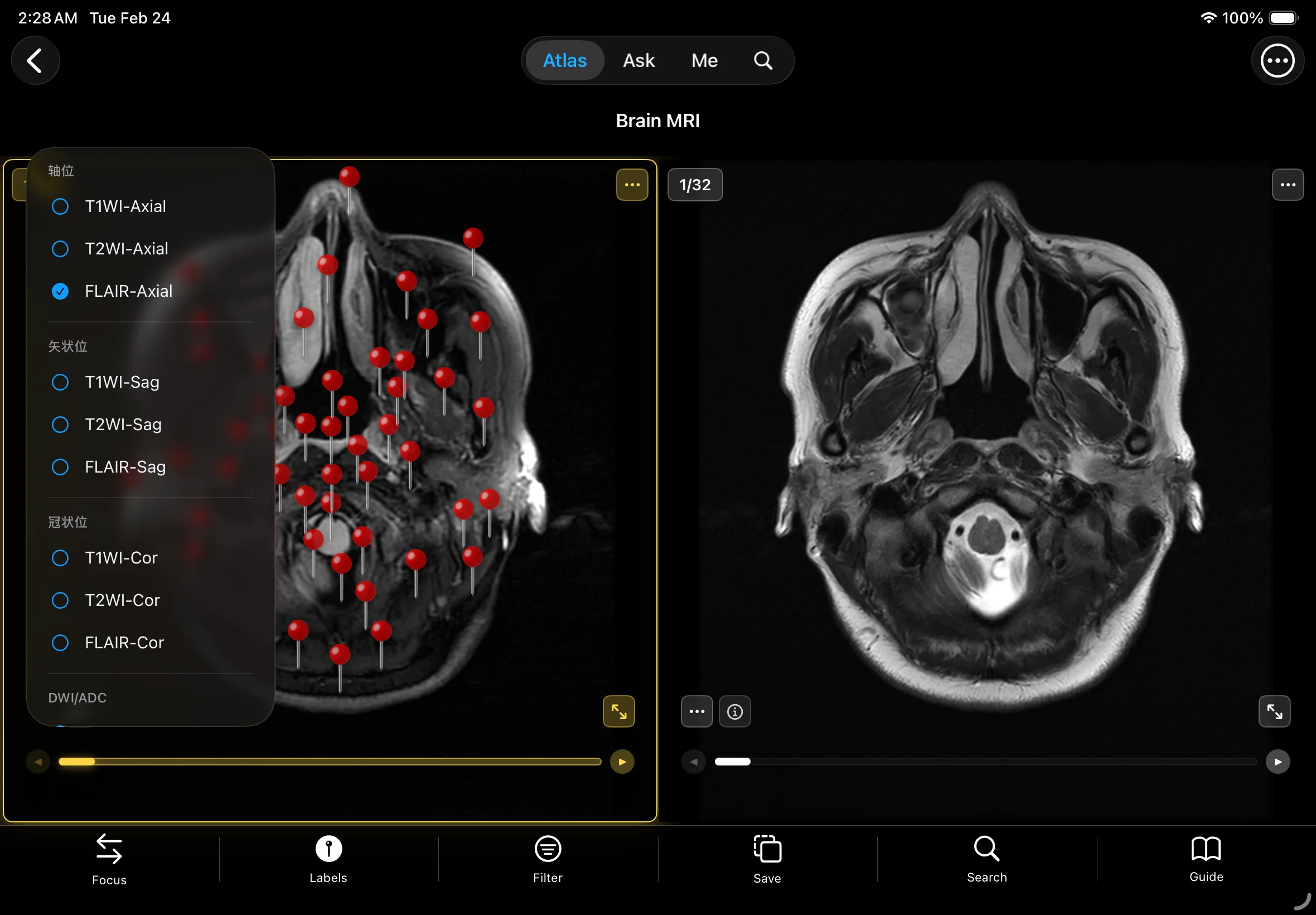 完整序列 + 薄层扫描